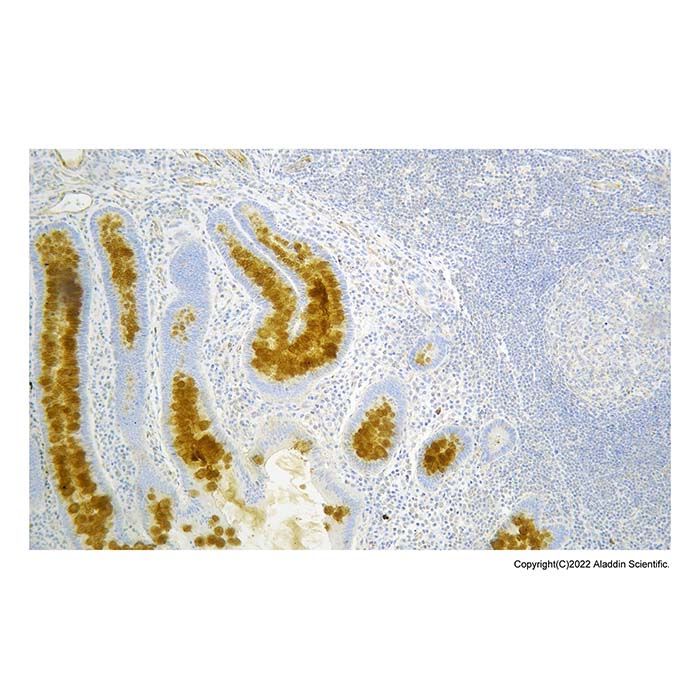 Recombinant VEGF Receptor 2 Antibody