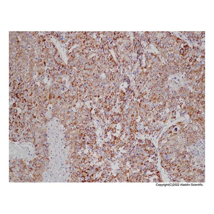 Recombinant VEGFA Antibody