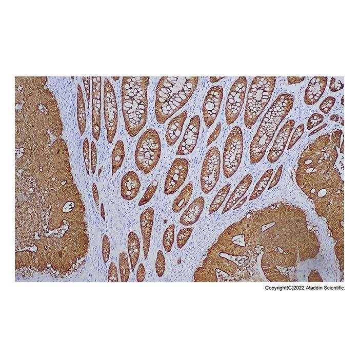 Recombinant Villin Antibody