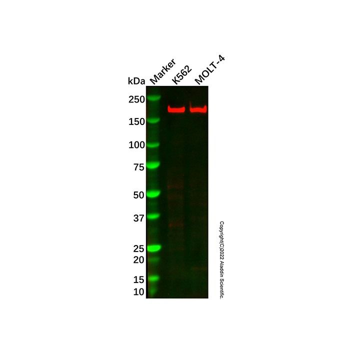 Recombinant WRN Antibody