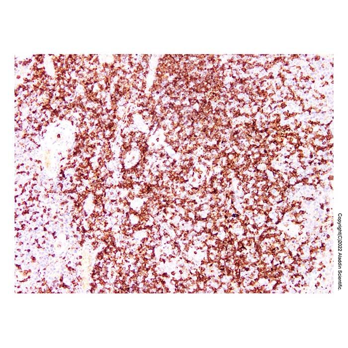 ZAP70 Mouse mAb