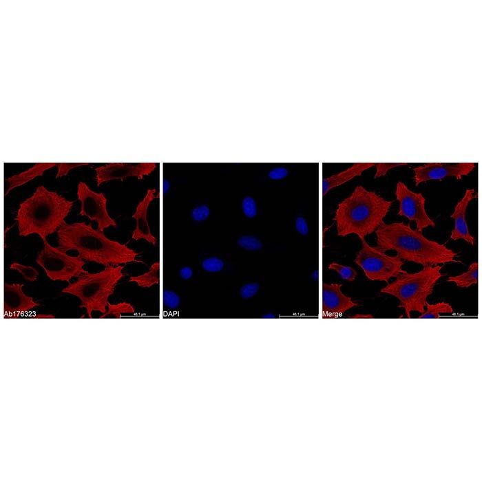 beta Actin Mouse mAb (TRITC)