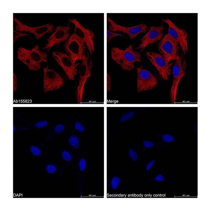Goat Anti-Mouse IgG H&L (TRITC)