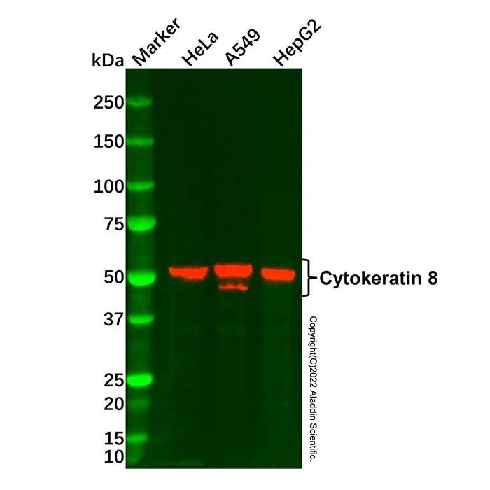 Cytokeratin 8 Mouse mAb