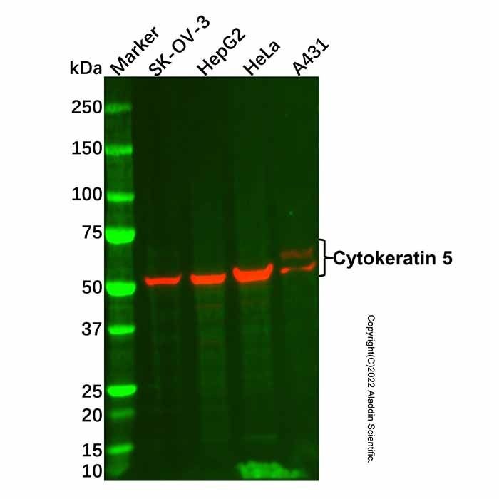 Cytokeratin 5 Mouse mAb