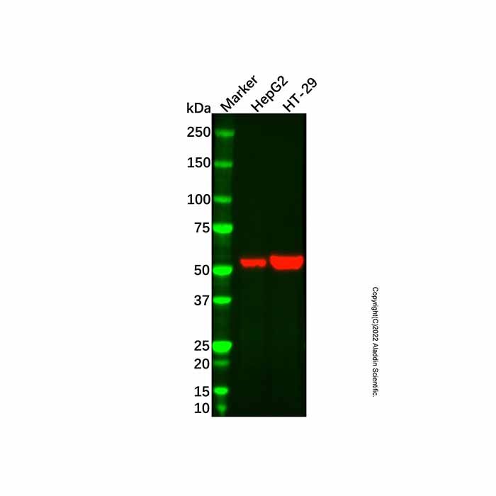 ALDH1A1 Mouse mAb