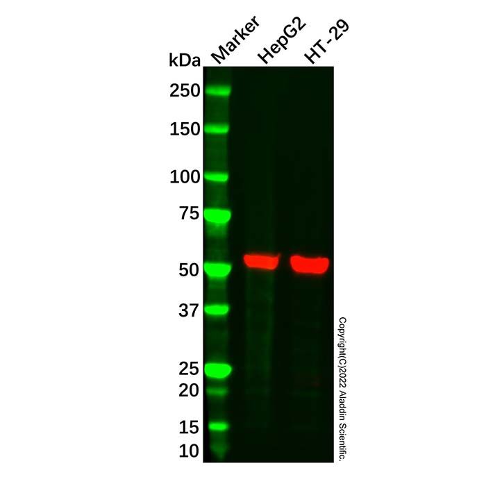 ALDH1A1 Mouse mAb