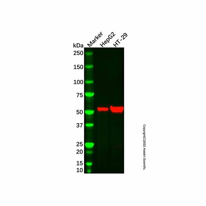 ALDH1A1 Mouse mAb
