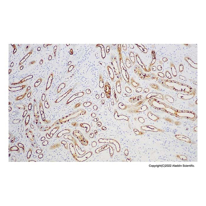 Recombinant BCA-225 Antibody