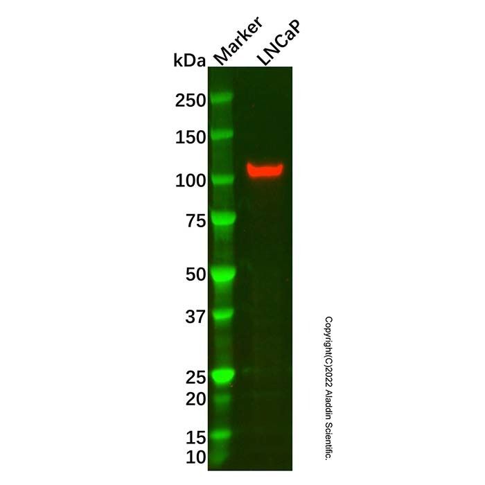 E-Cadherin Mouse mAb