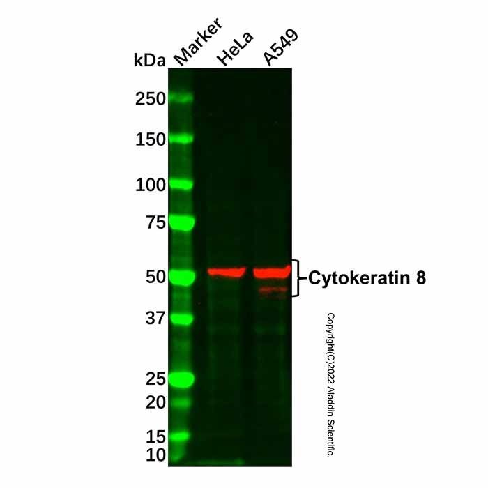 Cytokeratin 8 Mouse mAb