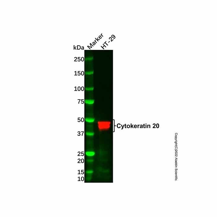 Cytokeratin 20 Mouse mAb