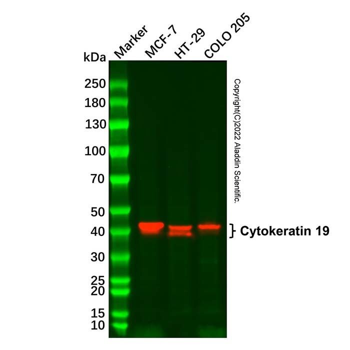 Cytokeratin 19 Mouse mAb