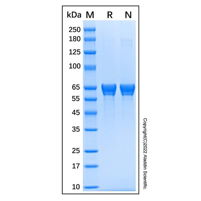 Recombinant Human Carnosine Dipeptidase 1 Protein