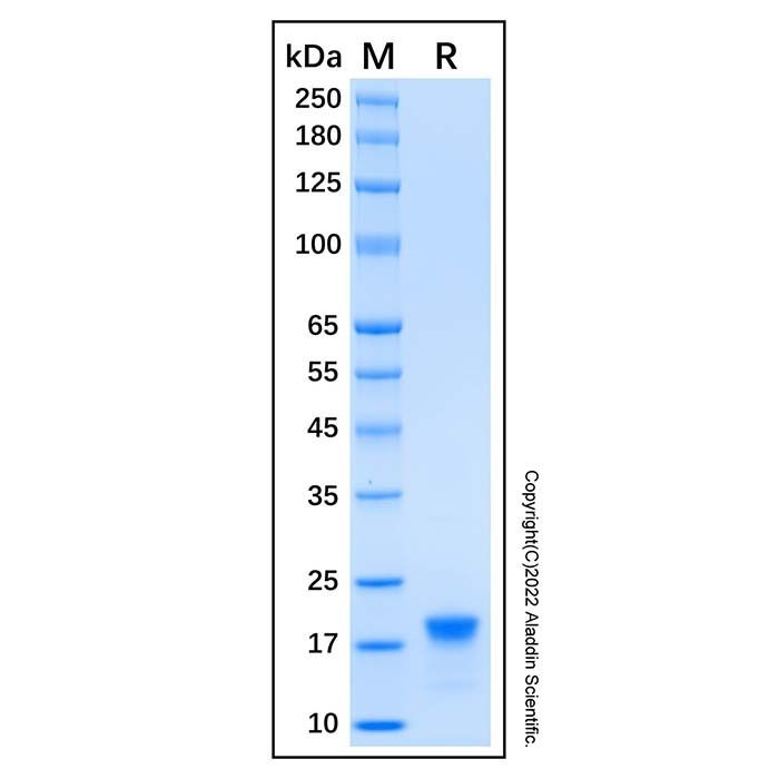 Recombinant Human CD20 Protein