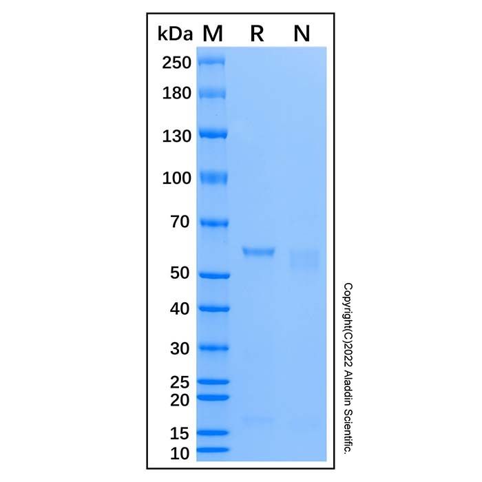 Recombinant Human SQSTM1/p62 Protein