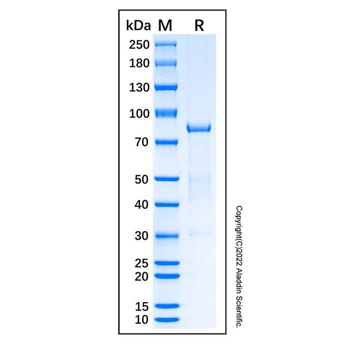 Recombinant Human SDHA Protein