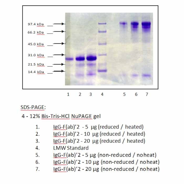免疫球蛋白G (IgG), F (ab')₂片段 来源于人血浆