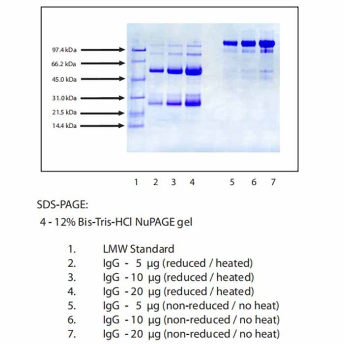 Immunoglobulin G (IgG), Normal Human Plasma