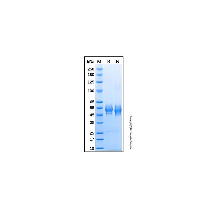 Recombinant Human B4GalT1 Protein