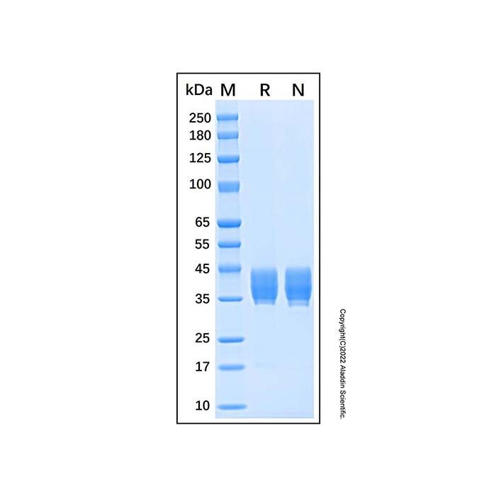 Recombinant Human CD157 Protein