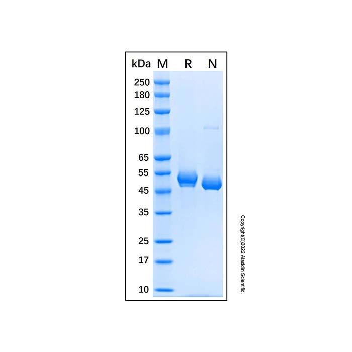 Recombinant Human Chitotriosidase/CHIT1 Protein