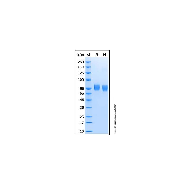 Recombinant Human CHST15 Protein