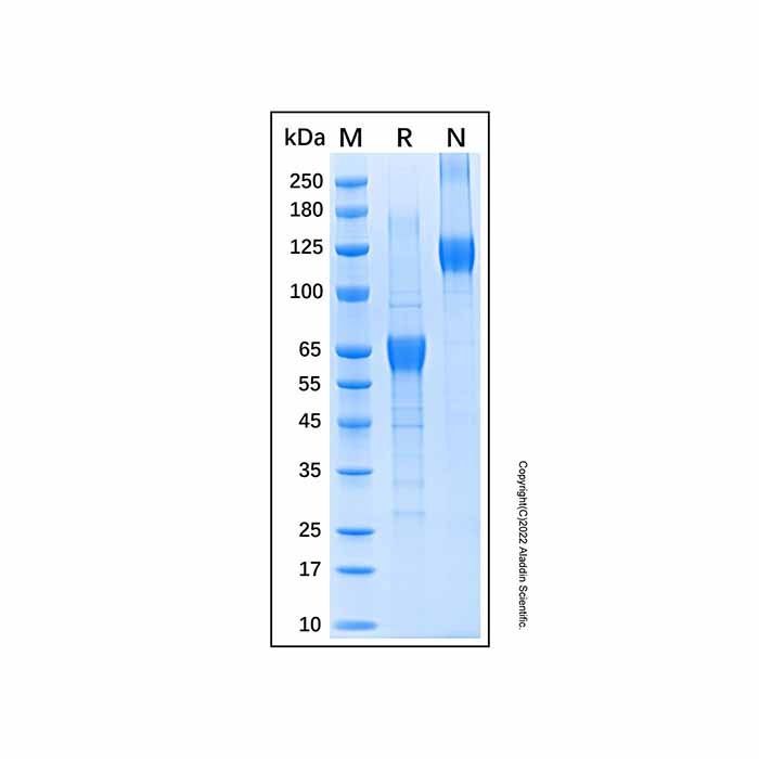 Recombinant Human IL-12 p35 Protein