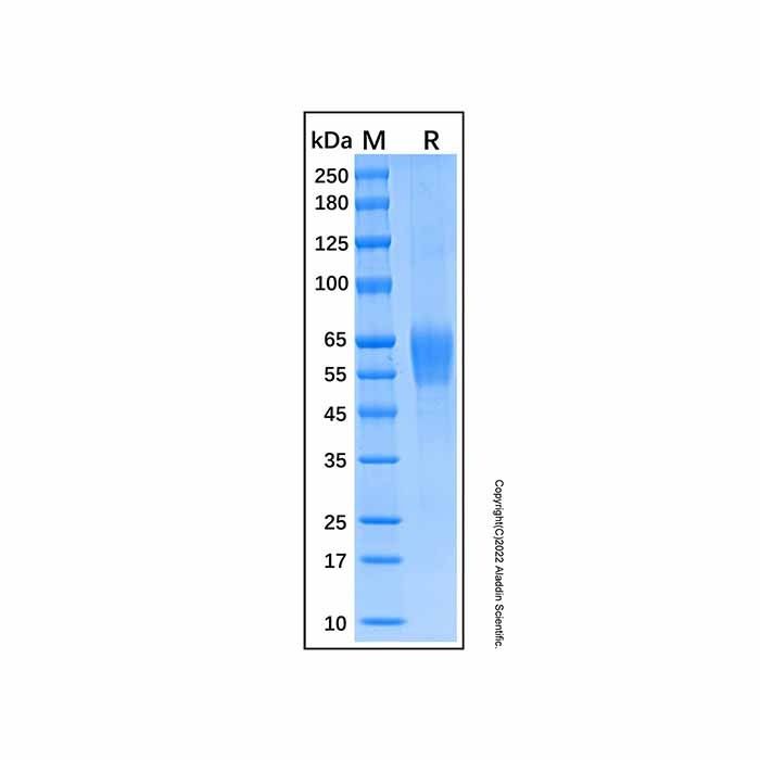 Recombinant Human IL-1Rrp2/IL-1R6 Protein