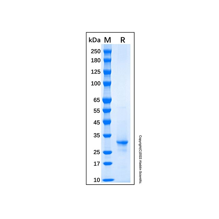 Recombinant Human Lamin B1 Protein