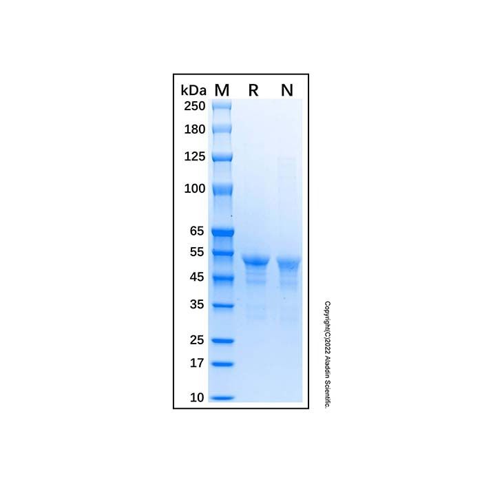 Recombinant Human Carbonic Anhydrase IX Protein