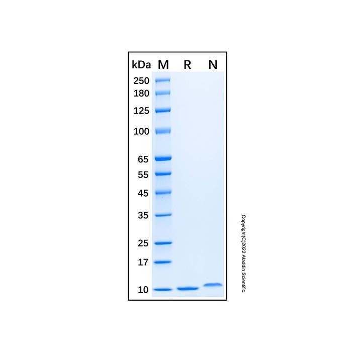 Recombinant Human CXCL5/ENA-70 Protein