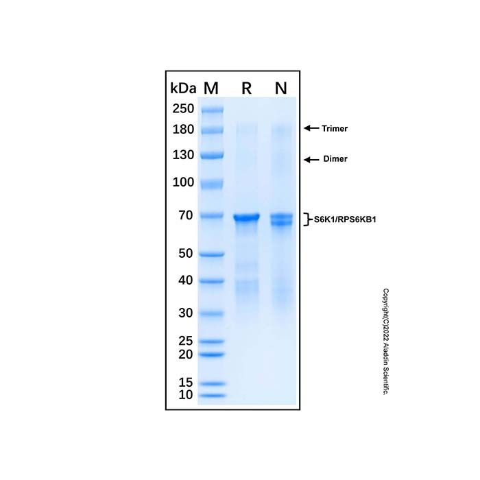 Recombinant Human p70 S6 Kinase Protein
