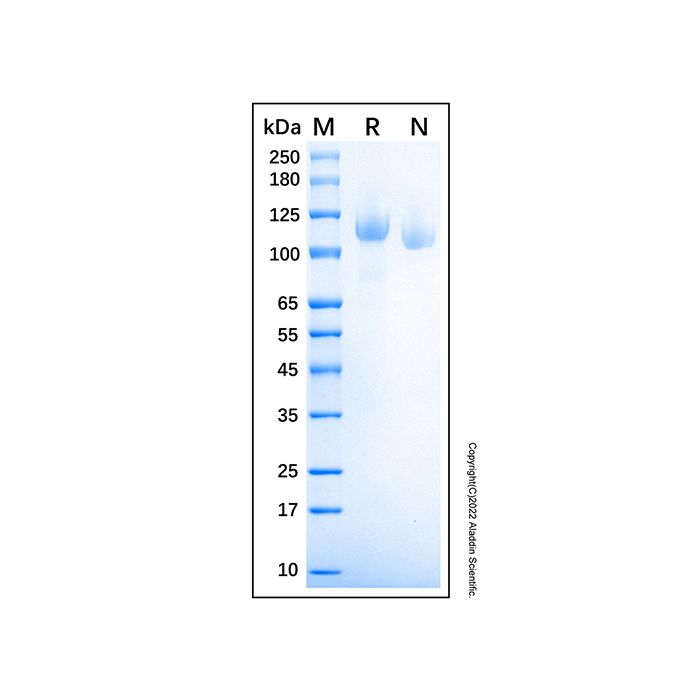 Recombinant Human ROBO1/DUTT1 Protein