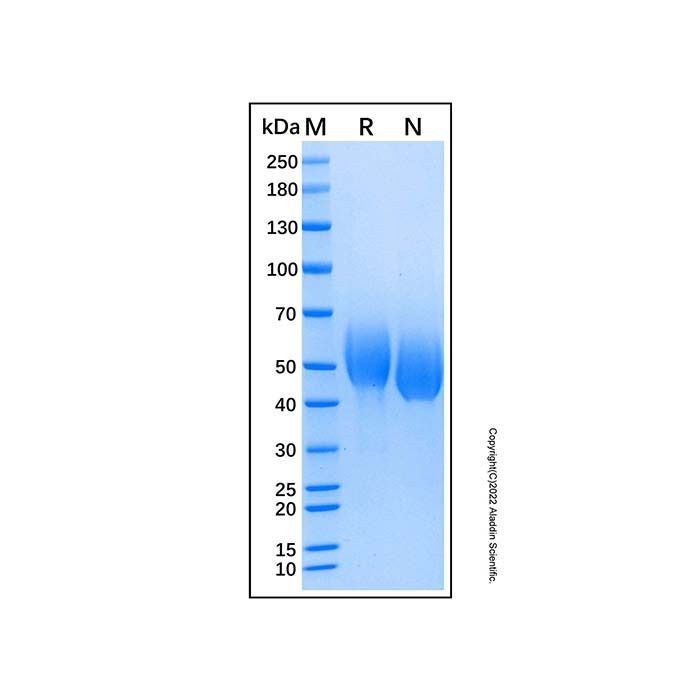 Recombinant Human IL-1 RI Protein
