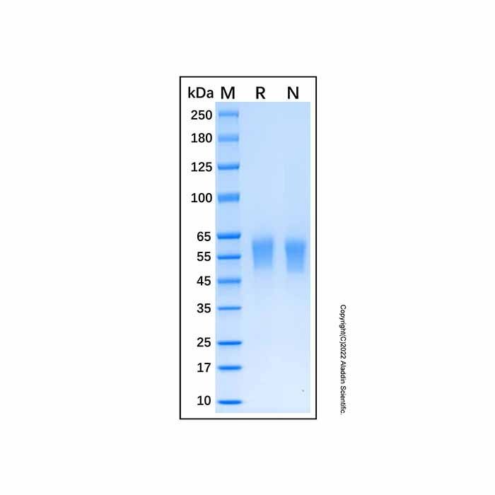 Recombinant Human DDR2 Protein