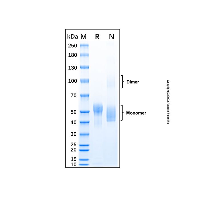 Recombinant Human Fetuin A/AHSG Protein