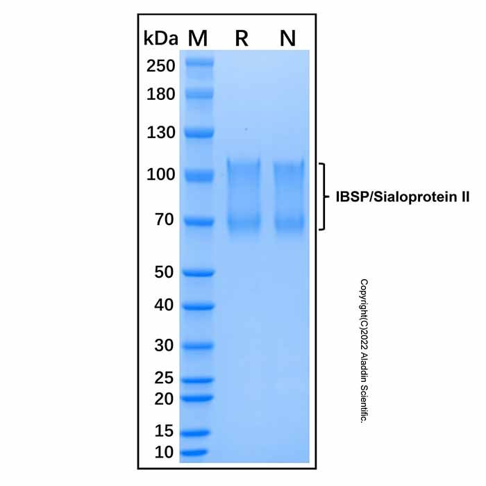 Recombinant Human IBSP/Sialoprotein II Protein