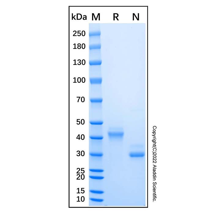 Recombinant Human CD5L Protein