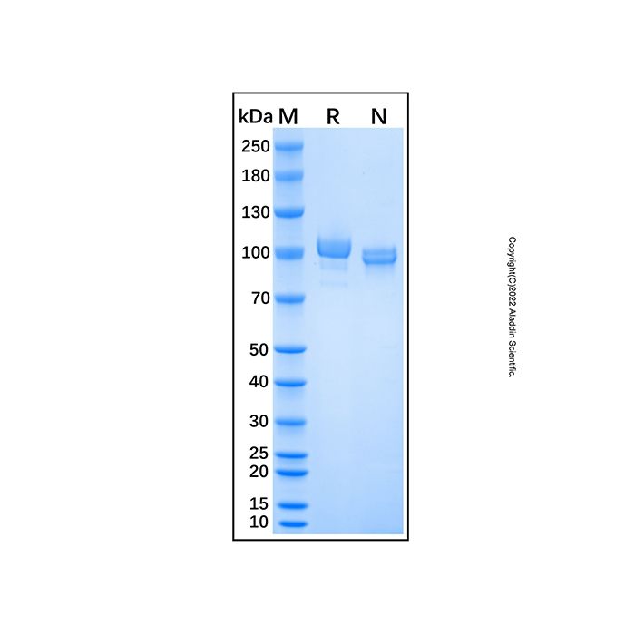 Recombinant Human ENPP-2/Autotaxin Protein