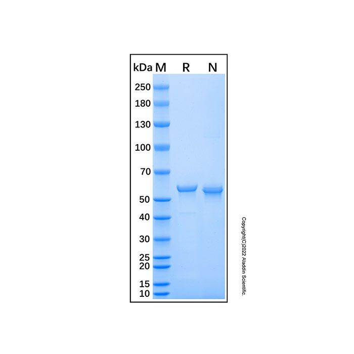 Recombinant Human GALNT2 Protein