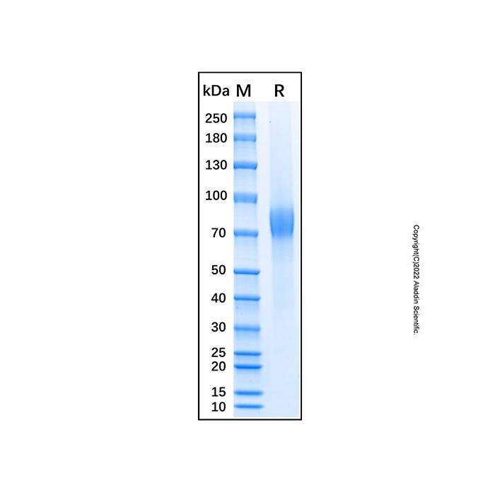 Recombinant Human Progranulin Protein