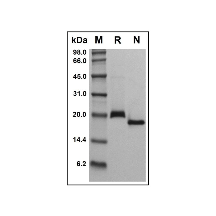 Recombinant Human RANK Protein
