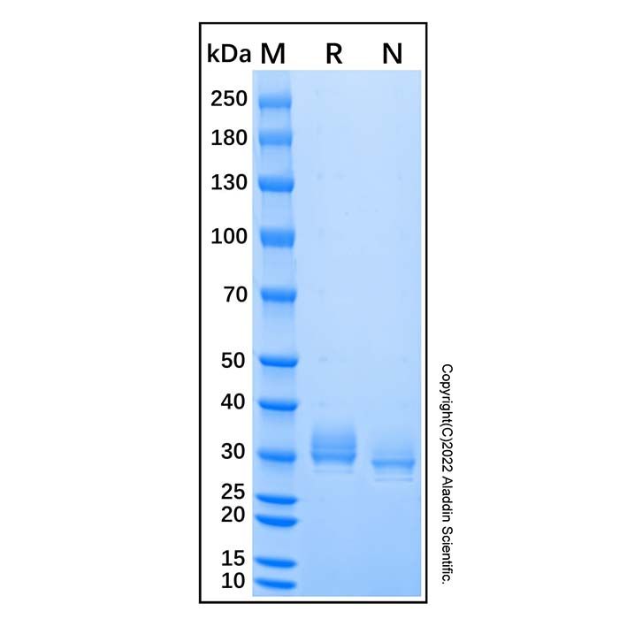 Recombinant Human Siglec-15 Protein