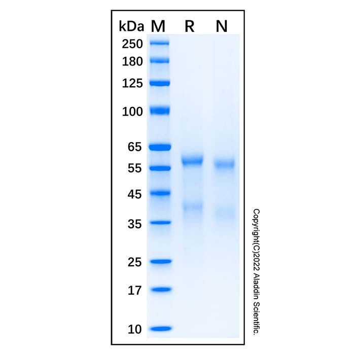 Recombinant Human ADAM8 Protein