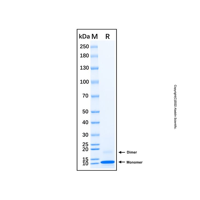 Recombinant Human CCL19/MIP-3 beta Protein 
