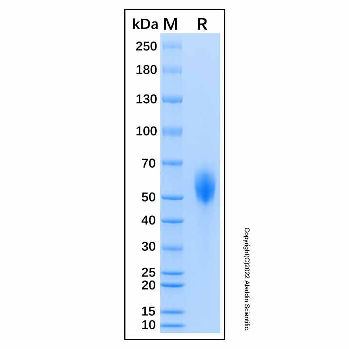Recombinant Human CD21 Protein