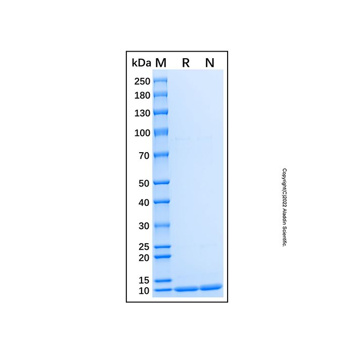 Recombinant Human GSK-3 beta/GSK3B Protein