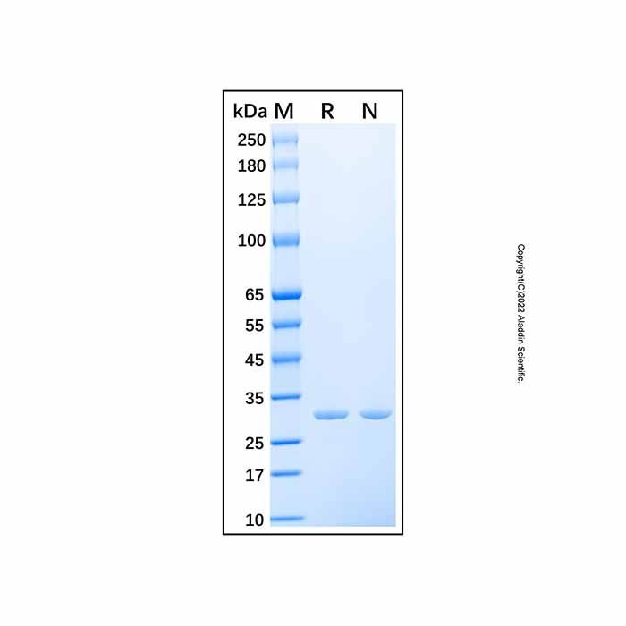 Recombinant Human Carbonic Anhydrase XIII Protein