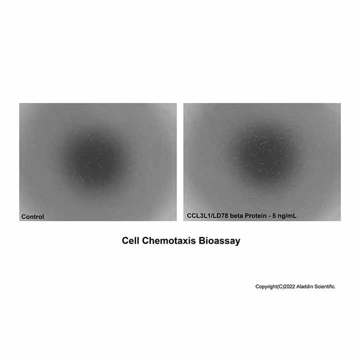 Recombinant Human CCL3L1/LD78 beta Protein